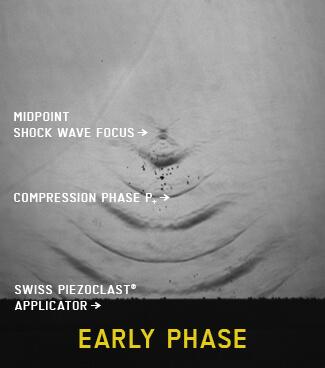 EMS Swiss DolorClast_XRay_368x325px_Focused_EarlyPhase