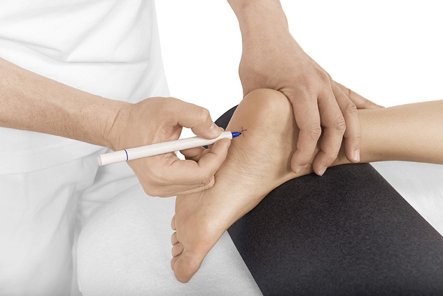 Plantar_Fasciitis_KRN7103 Plantar_Fasciitis_KRN7103